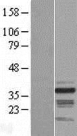 Novus Biologicals&trade;&nbsp;RNF41 Overexpression Lysate