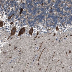 RNF41 Antibody, Novus Biologicals:Antibodies:Primary Antibodies