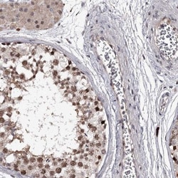 RNF44 Antibody, Novus Biologicals:Antibodies:Primary Antibodies