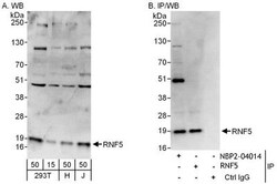 RNF5 Antibody, Novus Biologicals 0.1mg; Unlabeled:Antibodies, Polyclonal