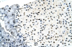 RNF6 Antibody, Novus Biologicals:Antibodies:Primary Antibodies