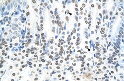 RNF6 Antibody, Novus Biologicals:Antibodies:Primary Antibodies