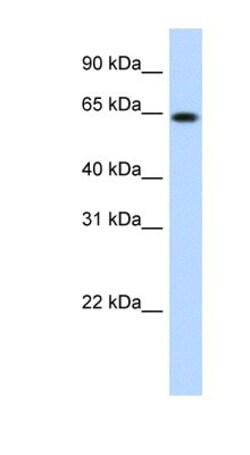 RNF6 Antibody, Novus Biologicals:Antibodies:Primary Antibodies