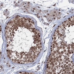 RNF6 Antibody, Novus Biologicals 0.1mL; Unlabeled:Antibodies, Polyclonal