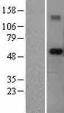 Novus Biologicals&trade;&nbsp;RNF89 Overexpression Lysate