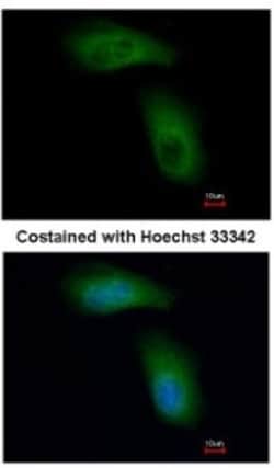 RNF98 Antibody, Novus Biologicals 0.1mg; Unlabeled:Antibodies, Polyclonal