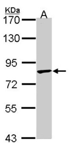 RNF98 Antibody, Novus Biologicals 0.1mg; Unlabeled:Antibodies, Polyclonal