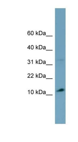 RNF98 Antibody, Novus Biologicals 100&mu;L; Unlabeled:Antibodies, Polyclonal