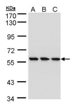 RNGTT Antibody, Novus Biologicals 0.1mL; Unlabeled:Antibodies, Polyclonal