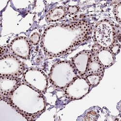 RNMT Antibody, Novus Biologicals 0.1mL; Unlabeled:Antibodies, Polyclonal