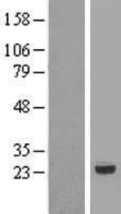 Novus Biologicals&trade;&nbsp;RNMTL1 Overexpression Lysate