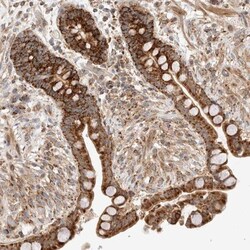 RNMTL1 Antibody, Novus Biologicals 25 &mu;L; Unlabeled:Antibodies, Polyclonal