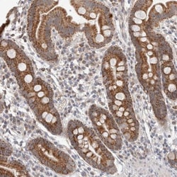 RNMTL1 Antibody, Novus Biologicals:Antibodies:Primary Antibodies