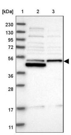 RNMTL1 Antibody, Novus Biologicals 25 &mu;L; Unlabeled:Antibodies, Polyclonal