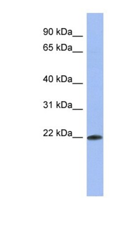 RNPC1 Antibody, Novus Biologicals 0.05mg; Unlabeled:Antibodies, Polyclonal