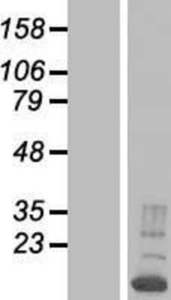Novus Biologicals RNPC1 Overexpression Lysate 0.1 mg | Buy Online | Novus Biologicals&trade; | Fisher Scientific