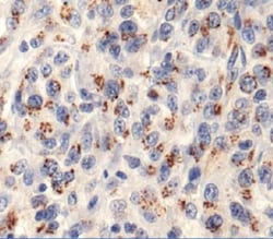 ROBLD3 Antibody, Novus Biologicals 0.05mL; Unlabeled:Antibodies, Polyclonal
