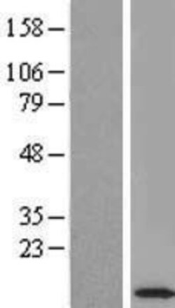 Novus Biologicals&trade;&nbsp;ROBLD3 Overexpression Lysate