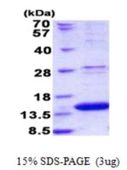 Novus Biologicals&trade;&nbsp;Recombinant Human ROBLD3 His Protein