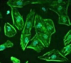 ROBO1 Antibody, Novus Biologicals 0.1mg; Unlabeled:Antibodies, Polyclonal