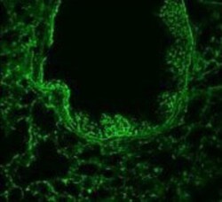 ROBO1 Antibody, Novus Biologicals 0.1mg; Unlabeled:Antibodies, Polyclonal