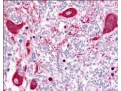 ROBO1 Antibody, Novus Biologicals 0.1mg; Unlabeled:Antibodies, Polyclonal