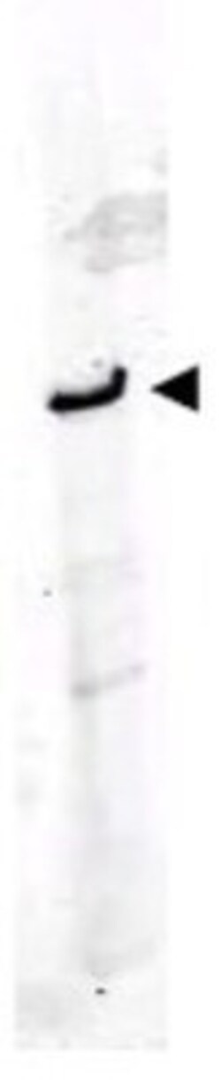 ROBO1 Antibody, Novus Biologicals 0.1mg; Unlabeled:Antibodies, Polyclonal