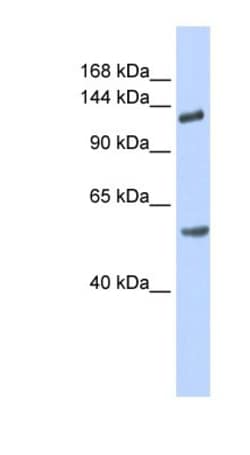ROBO2 Antibody, Novus Biologicals 0.05mg; Unlabeled:Antibodies, Polyclonal