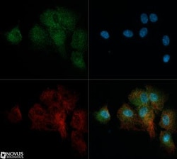 ROBO4 Antibody, Novus Biologicals 0.025mL; Unlabeled:Antibodies, Polyclonal