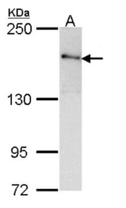 ROCK2 Antibody, Novus Biologicals 0.1mL; Unlabeled:Antibodies, Polyclonal