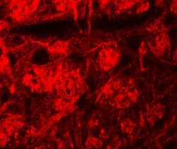 ROCK2 Antibody - BSA Free, Novus Biologicals 0.1mg; Unlabeled:Antibodies,