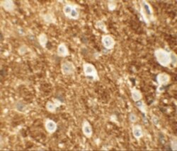 ROCK2 Antibody - BSA Free, Novus Biologicals 0.1mg; Unlabeled:Antibodies,