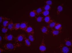 ROCK2 Antibody, Novus Biologicals 0.1mg; Unlabeled:Antibodies, Polyclonal
