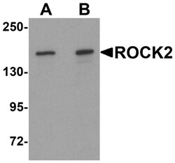 ROCK2 Antibody - BSA Free, Novus Biologicals 0.1mg; Unlabeled:Antibodies,