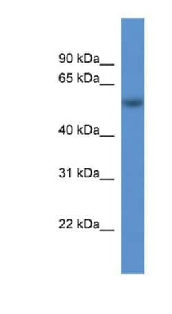 ROD1 Antibody, Novus Biologicals 20&mu;L; Unlabeled:Antibodies, Polyclonal