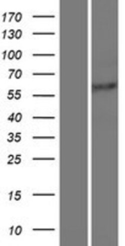 Novus Biologicals&trade;&nbsp;ROD1 Overexpression Lysate