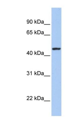 ROM1 Antibody, Novus Biologicals 0.05mg; Unlabeled:Antibodies, Polyclonal