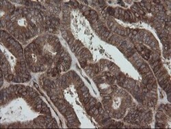 ROMO1 Antibody (OTI2C12), Novus Biologicals 0.1mL; Unlabeled:Antibodies,