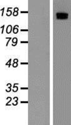 Novus Biologicals&trade;&nbsp;MSPR/Ron Overexpression Lysate