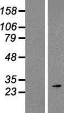 Novus Biologicals™ ROPN1 Overexpression Lysate