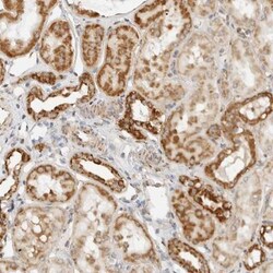 Roquin Antibody, Novus Biologicals 0.1mL; Unlabeled:Antibodies, Polyclonal
