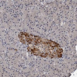 Roquin Antibody, Novus Biologicals 0.1mL; Unlabeled:Antibodies, Polyclonal