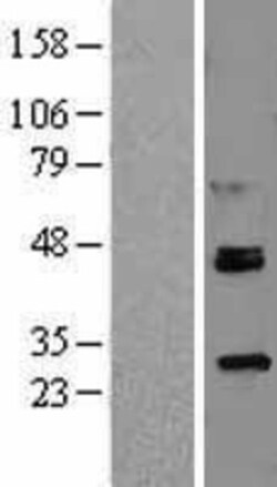 Novus Biologicals&trade;&nbsp;ROR alpha/NR1F1 Overexpression Lysate