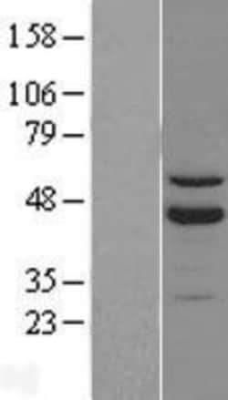 Novus Biologicals&trade;&nbsp;ROR beta Overexpression Lysate