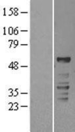 Novus Biologicals&trade;&nbsp;ROR gamma/RORC/NR1F3 Overexpression Lysate