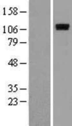 Novus Biologicals&trade;&nbsp;ROR1 Overexpression Lysate
