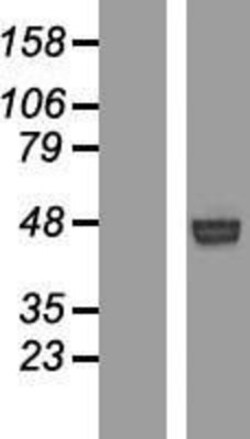 Novus Biologicals&trade;&nbsp;ROR1 Overexpression Lysate