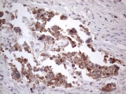 ROR beta Antibody (OTI1G1), Novus Biologicals 0.1 mL | Buy Online | Novus Biologicals | Fisher Scientific
