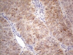 ROR beta Antibody (OTI1G1), Novus Biologicals 0.1 mL | Buy Online | Novus Biologicals | Fisher Scientific