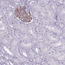 ROS Antibody, Novus Biologicals:Antibodies:Primary Antibodies